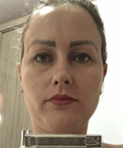 SELFIE, DRIVER LICENSE, SSN